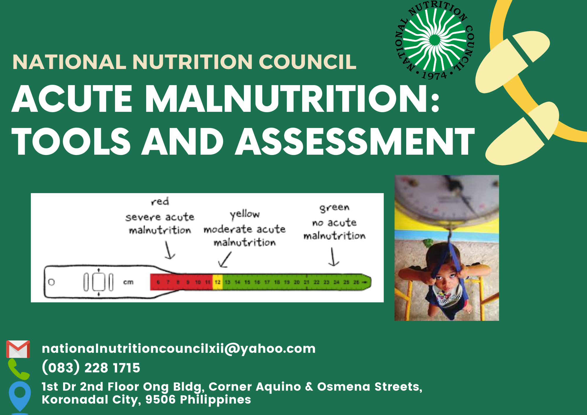 Acute Malnutrition T and A