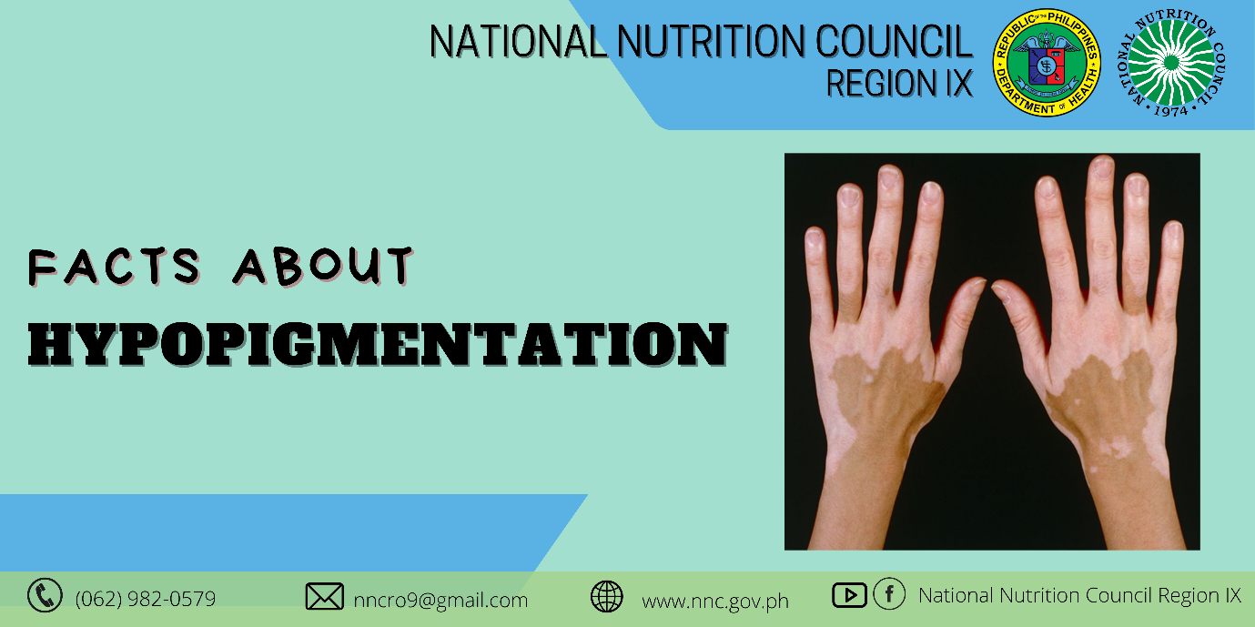 Hypopigmentation