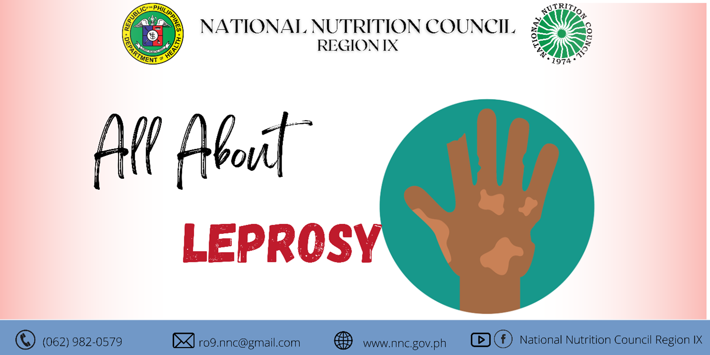 Leprosy