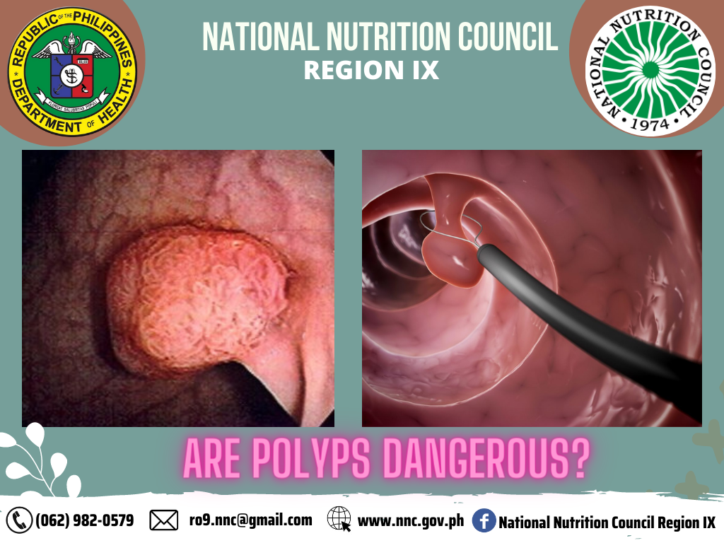 Polyps