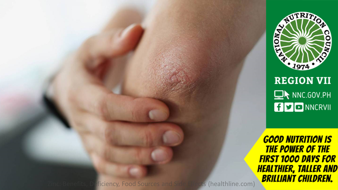 March2023 zinc deficiency