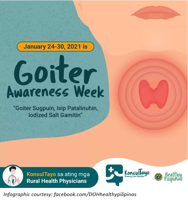 Goiter