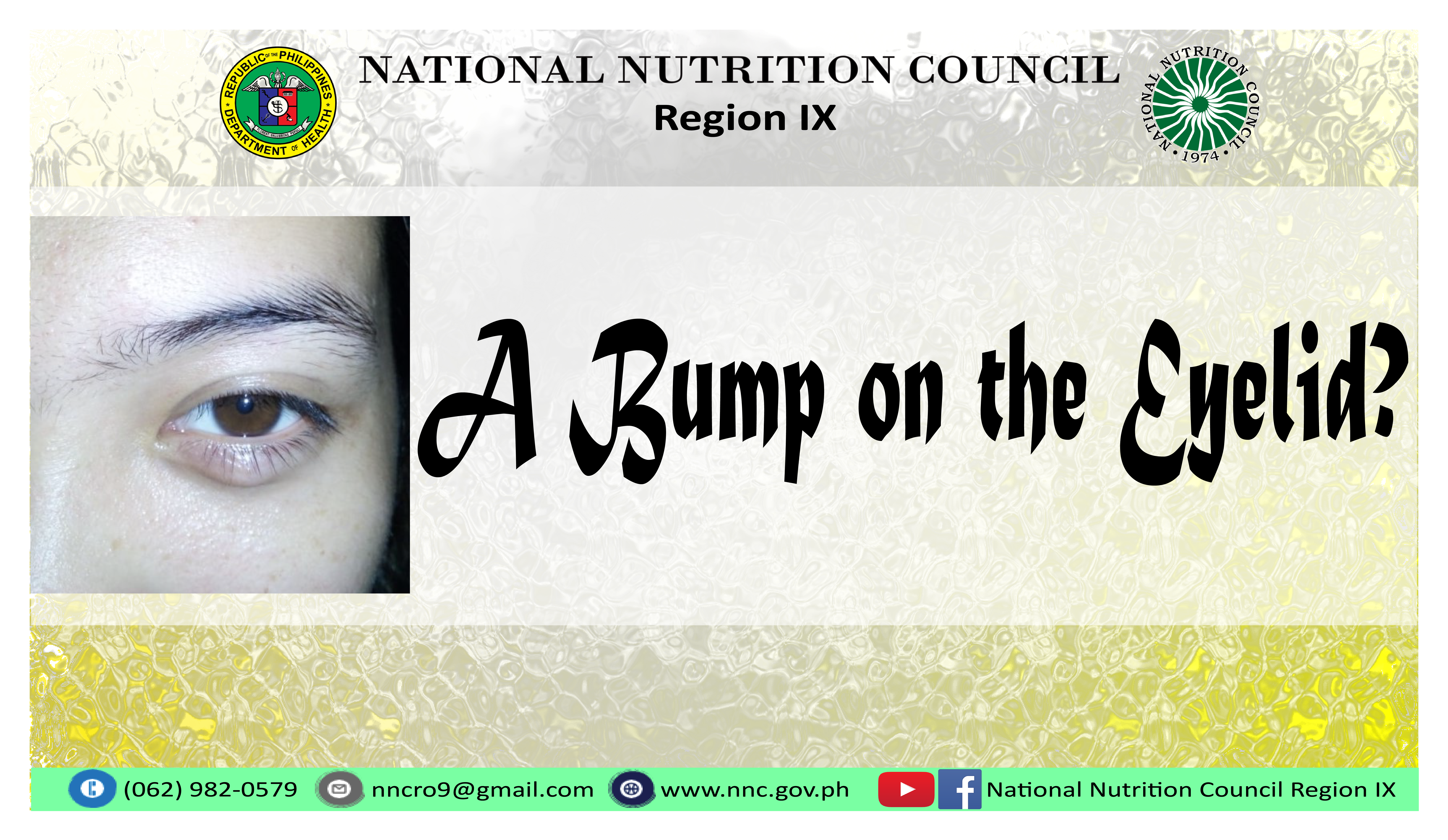 RO9 BumpEyelid