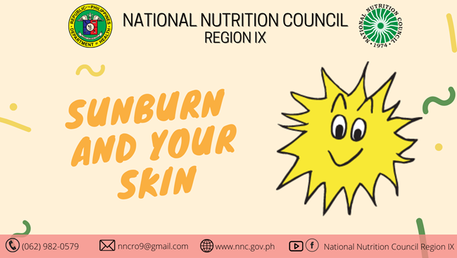 Sunburn